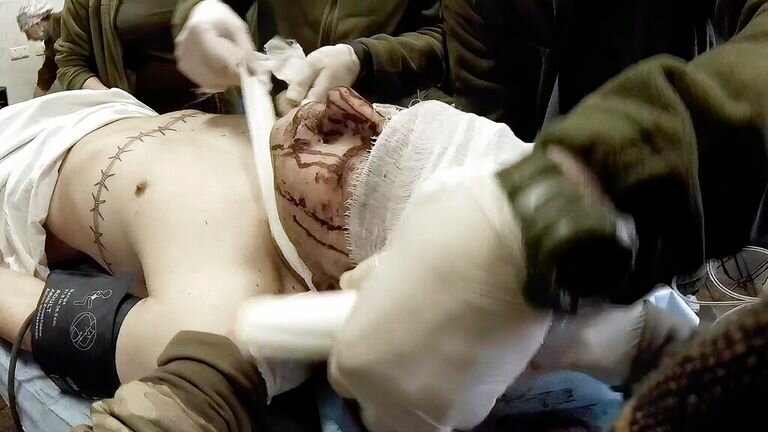 Yulia Paevskaya and other medical workers bandage head of injured Mariupol soldier